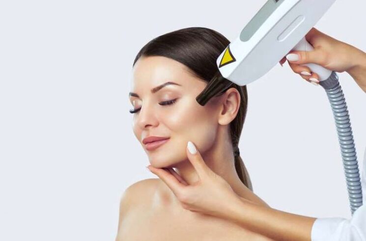 Laser removal of papillomas on the face.