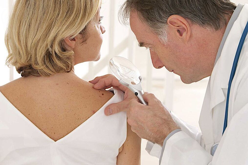 human papillomavirus diagnosis